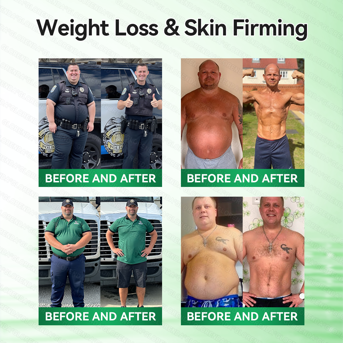 💫 𝐂𝐥𝐞𝐚𝐫𝐞𝐧𝐚® 𝑴𝒐𝒓𝒊𝒏𝙜𝙖 · 𝘽𝙚𝙧𝙗𝙚𝙧𝒊𝒏𝒆 × 𝐍𝐴𝑫+  10-𝐢𝐧-1 𝑨𝒅𝒗𝒂𝒏𝒄𝐞𝐝 𝑵𝒂𝙣𝙤 𝑴𝒊𝒄𝒓𝒐𝒏𝒆𝒆𝗱𝗹𝗲 𝐏𝐚𝒕𝗰𝗵 🇦🇺 ( 𝑱𝒖𝒔𝒕 𝒐𝒏𝒄𝒆 𝒂 𝒅𝒂𝒚, 𝒗𝒊𝒔𝒊𝒃𝒍𝒆 𝒄𝒉𝒂𝒏𝒈𝒆𝒔 𝒊𝒏 7 𝒅𝒂𝒚𝒔) 💪 𝑭𝒐𝒓 𝒐𝒃𝒆𝒔𝒊𝒕𝒚, 𝒍𝒐𝒐𝒔𝒆 𝒔𝒌𝒊𝒏, 𝒅𝒊𝒂𝒃𝒆𝒕𝒆𝒔, 𝒔𝒍𝒆𝒆𝒑 𝒂𝒑𝒏𝒆𝒂, 𝒋𝒐𝒊𝒏𝒕 𝒊𝒔𝒔𝒖𝒆𝒔, 𝒂𝒏𝒅 𝒎𝒐𝒓𝒆 🏥